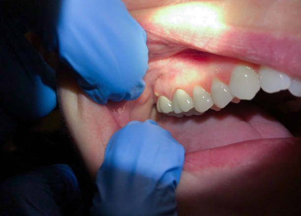 Best Emergency TMJ Treatment in Asotin, WA